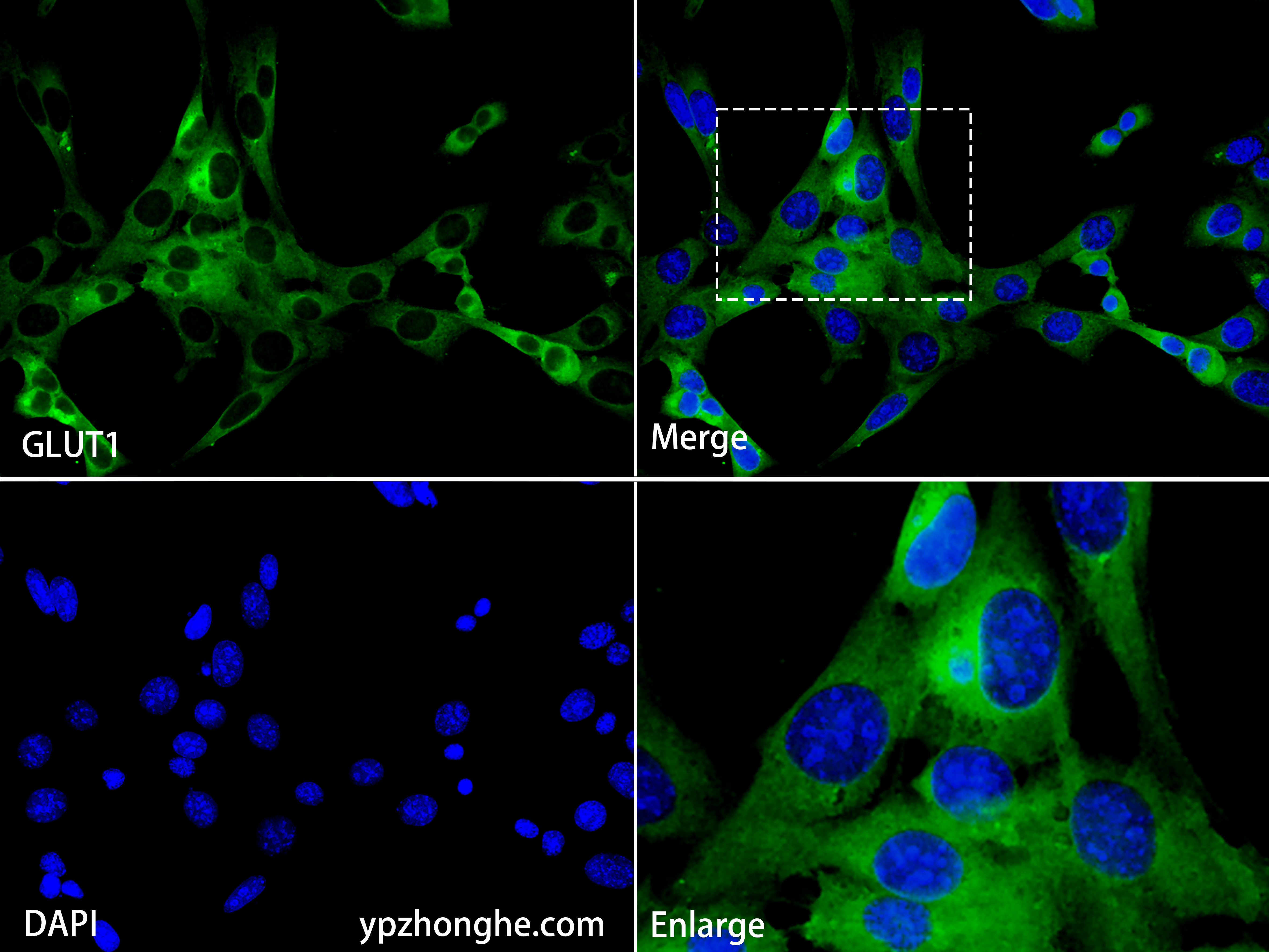 GluR1 (Y12) Rabbit mAb main image 0