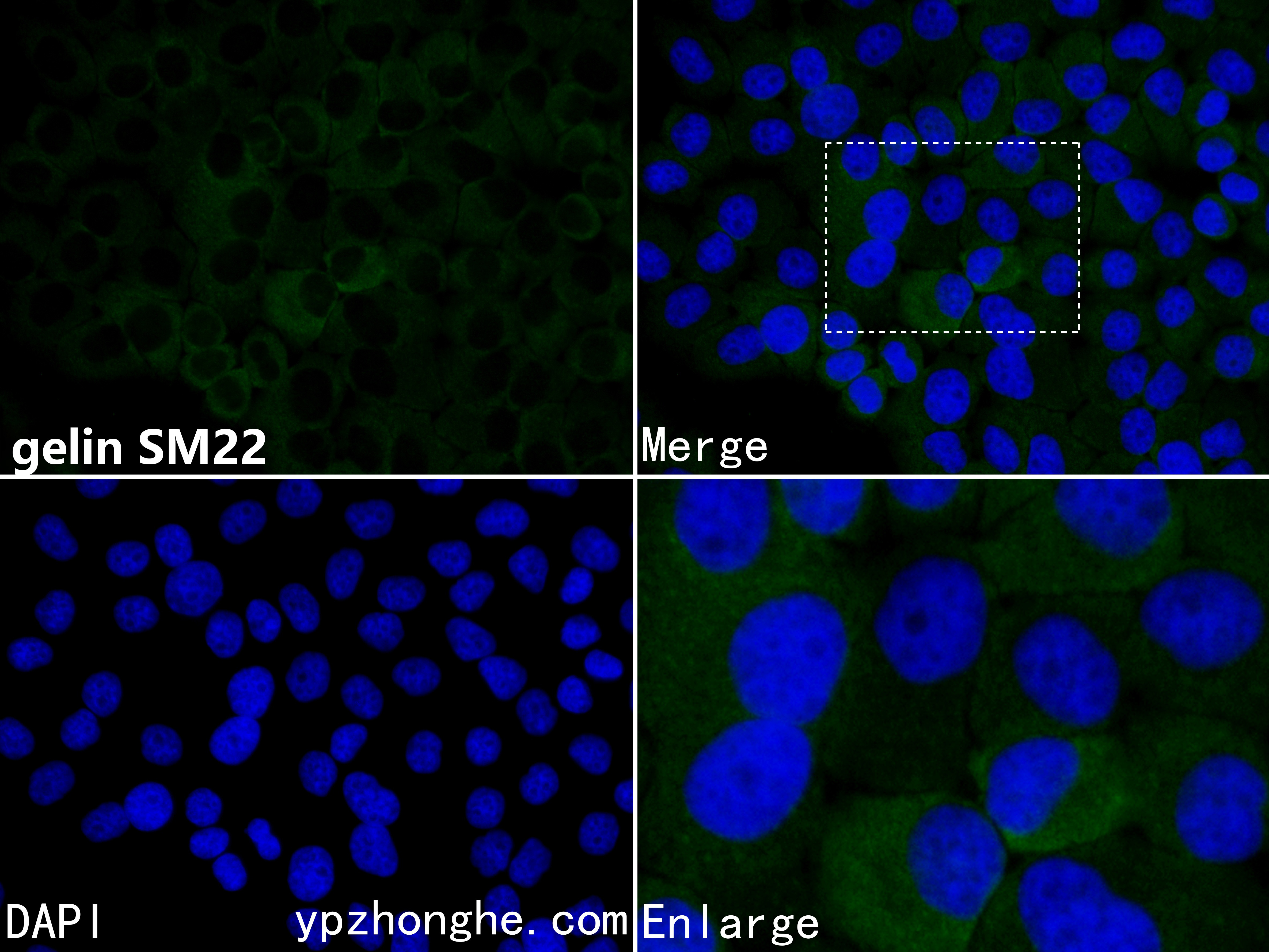 Sm22 Recombinant gelin SM22 Rabbit Monoclonal Antibody - 一品众合官网